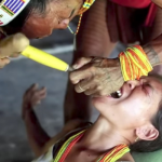 Tradisi Meruncingkan Gigi Suku Mentawai